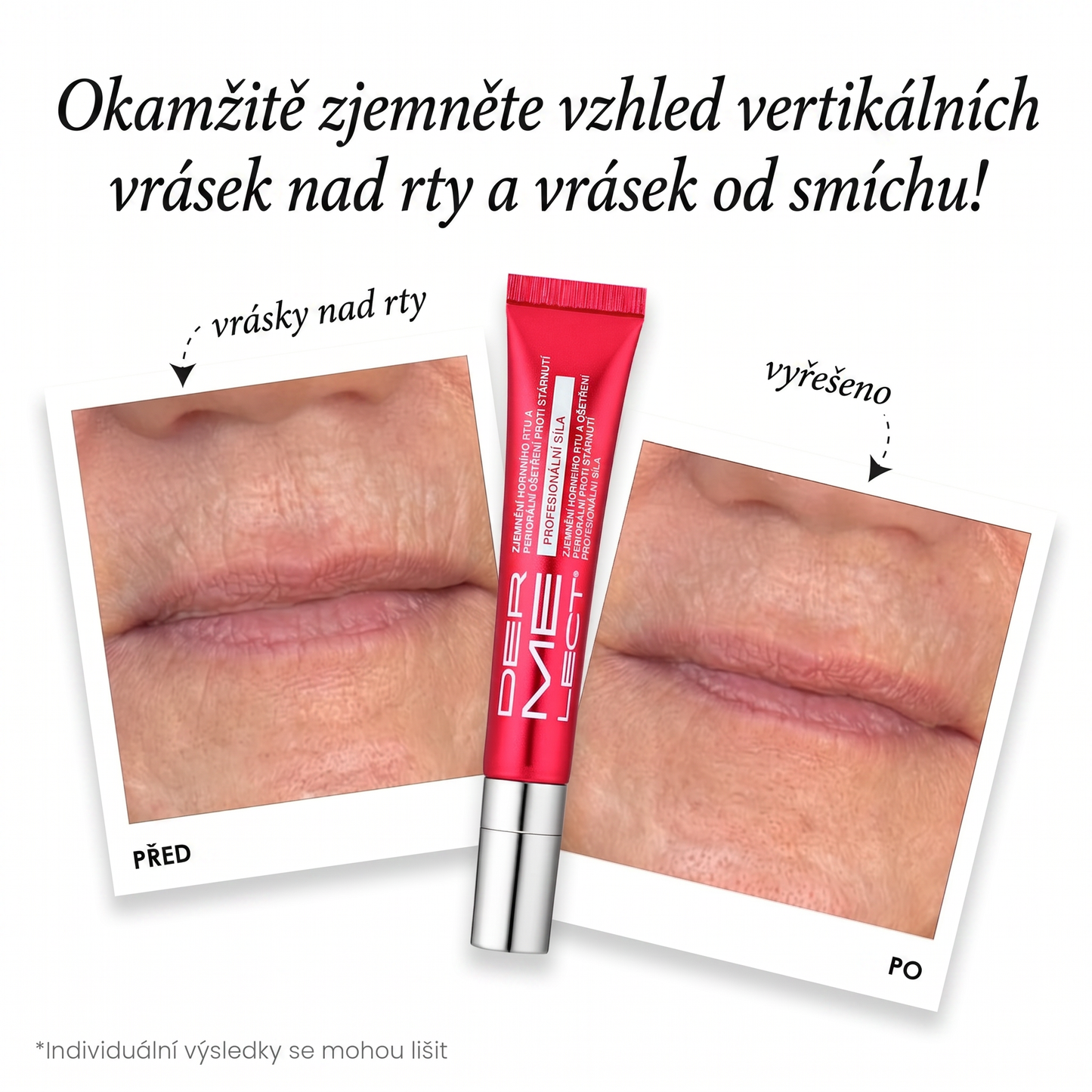 Periorální Anti-Aging Péče - Profesionální Síla